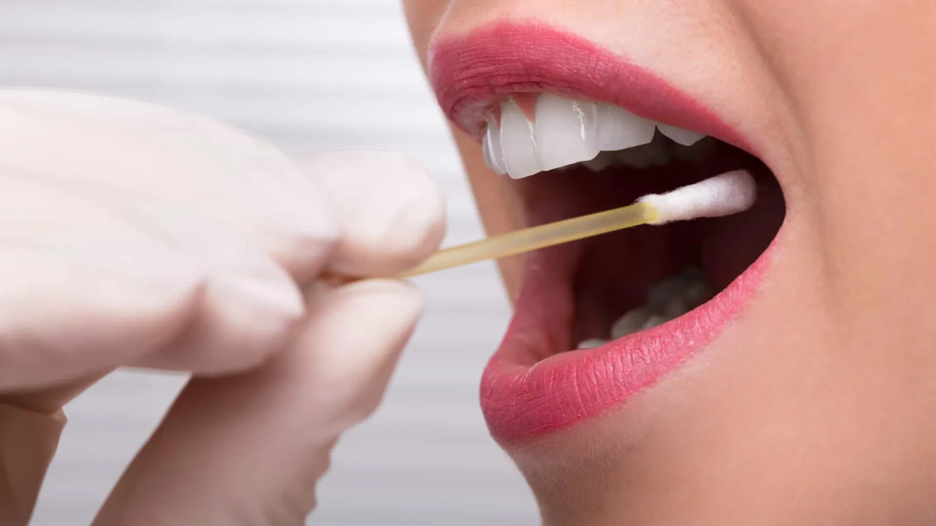 Teste de saliva para endometriose é considerado promissor, mas há ressalvas