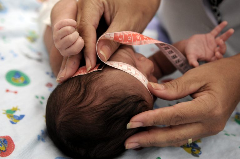 Uma médica mede a cabeça de um recém-nascido