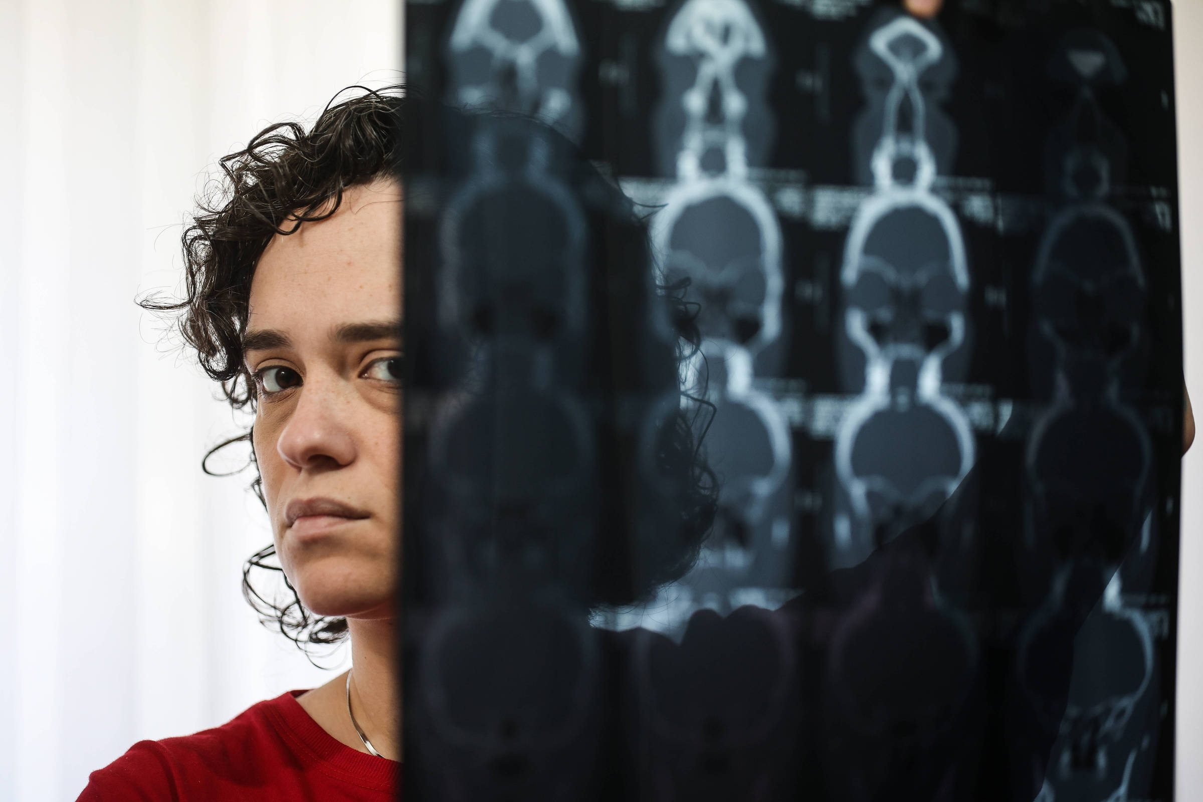 Uma mulher com cabelo cacheado e escuro está segurando uma radiografia em frente ao rosto. Ela tem uma expressão séria e está vestindo uma camiseta vermelha. Ao fundo, há uma cortina clara que deixa passar a luz.