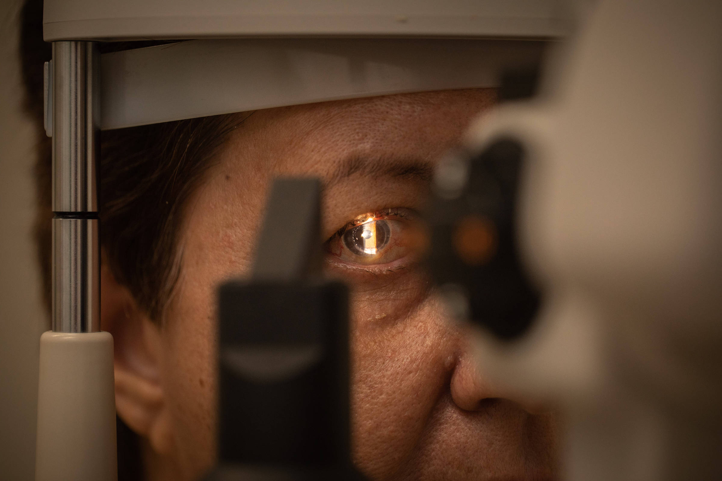 A imagem mostra um close de um olho humano durante um exame oftalmológico. Um feixe de luz está iluminando a pupila, permitindo a visualização do interior do olho. No fundo, é possível ver parte do equipamento utilizado para o exame, que inclui uma estrutura metálica e uma lente. A pessoa está olhando para frente, e a iluminação destaca detalhes do olho.