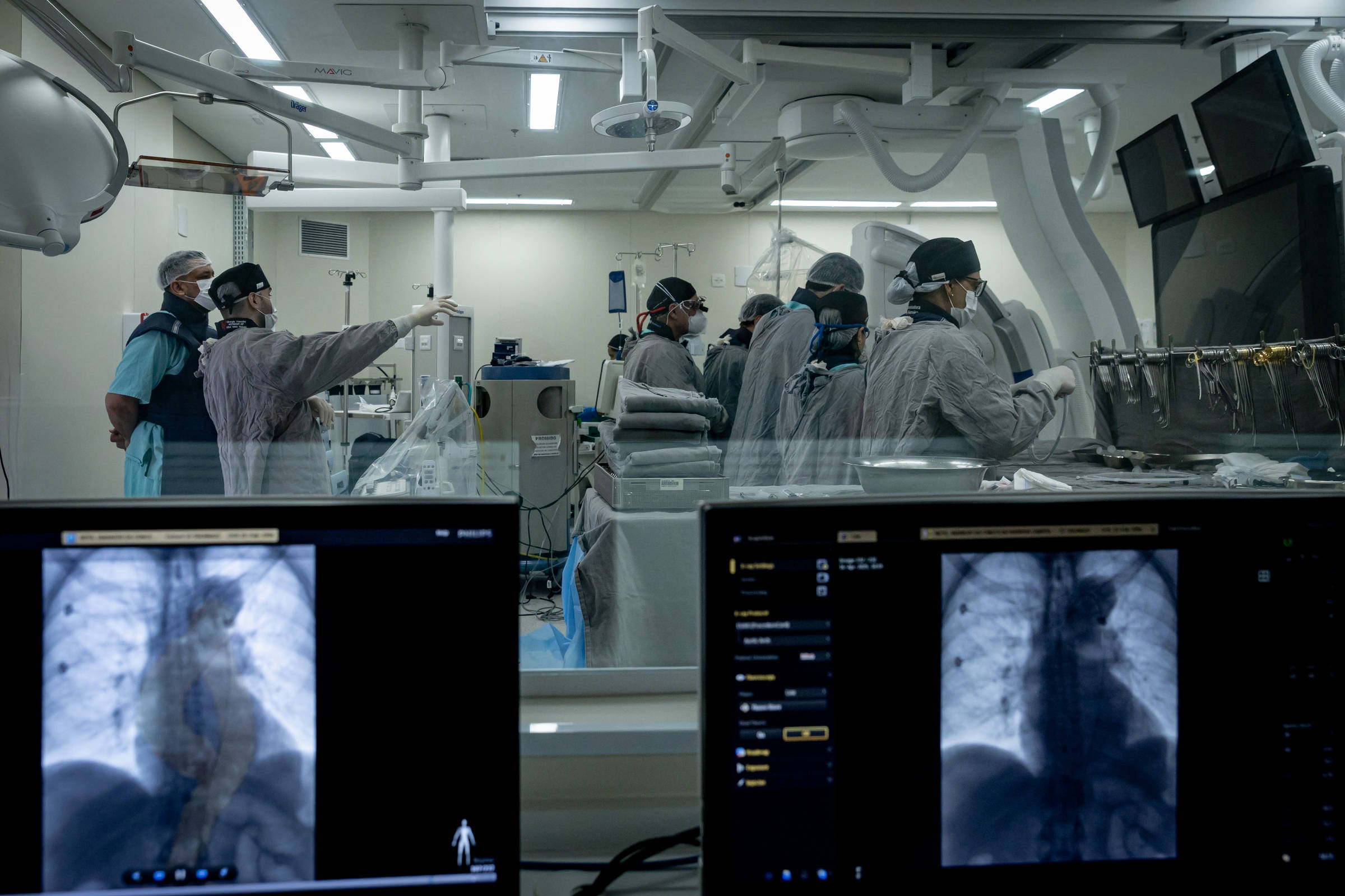 A imagem mostra uma sala de cirurgia moderna, com vários profissionais de saúde usando equipamentos de proteção, como máscaras e aventais. No primeiro plano, há dois monitores exibindo imagens de raios-X. Ao fundo, uma equipe está reunida em torno de uma mesa de operação, com um médico apontando para algo. O ambiente é bem iluminado e equipado com tecnologia médica avançada.
