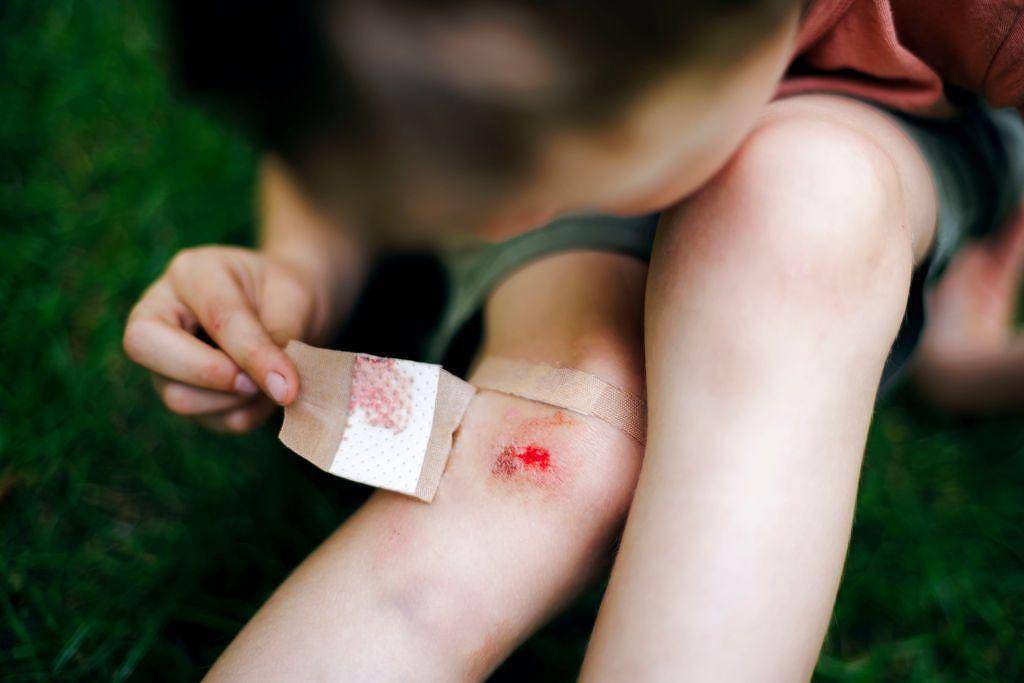 Criança sentada na grama segura curativo com manchas de sangue próximo a ferida aberta no joelho direito.